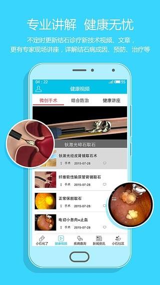 小石化了  v1.0.4图3