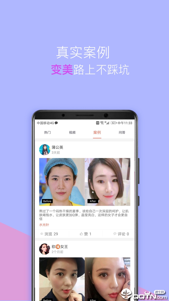 塑美  v2.4.7图2